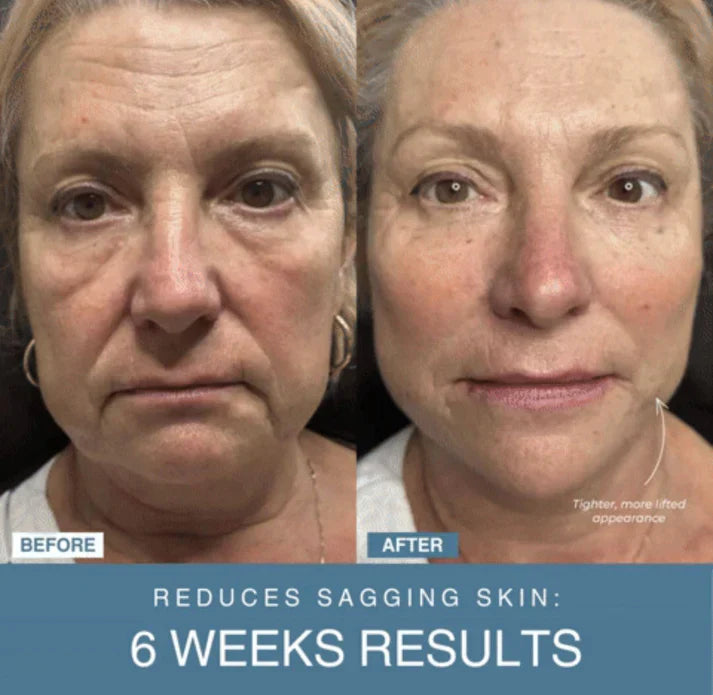 Nayzaar™ 7-in-1 LED Anti-Aging/Wrinkle Apparatus