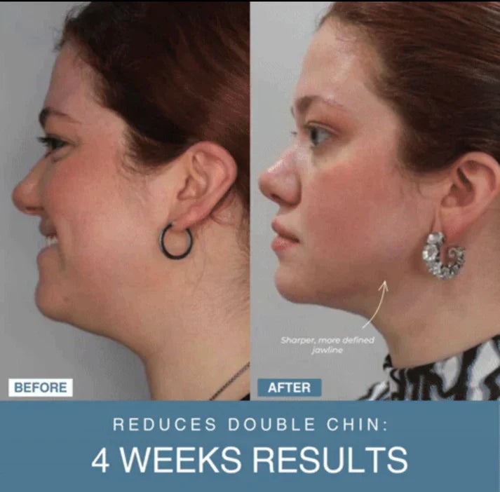 Nayzaar™ 7-in-1 LED Anti-Aging/Wrinkle Apparatus